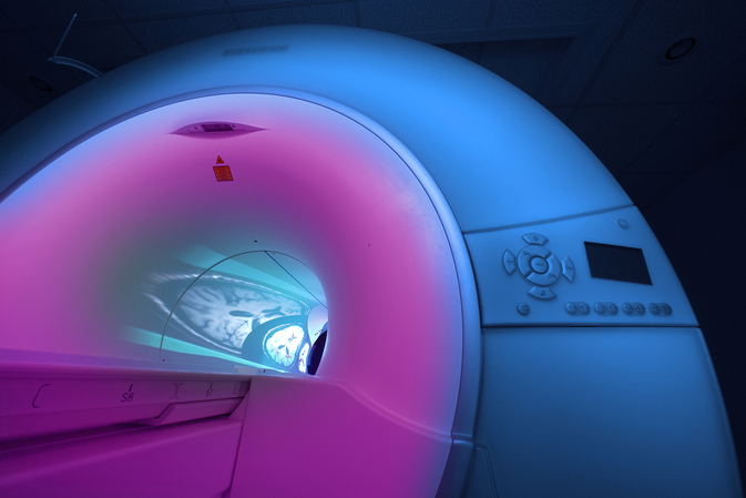 KI-Werkzeug diagnostiziert Hirntumore