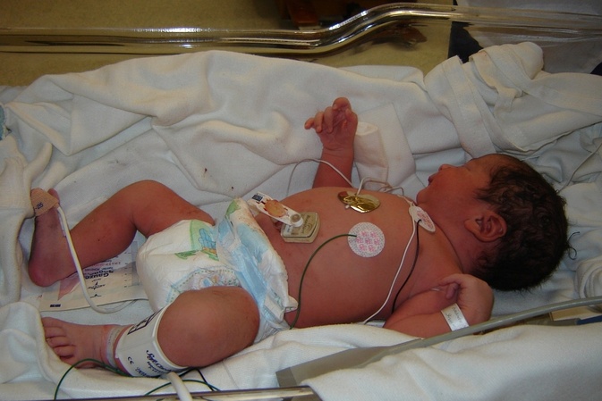 Neue Hightech-Herzkatheteranlage für Kinder