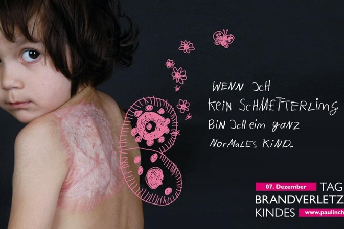 Kinder: Brandheiß! Brandgefährlich! Brandverletzt!