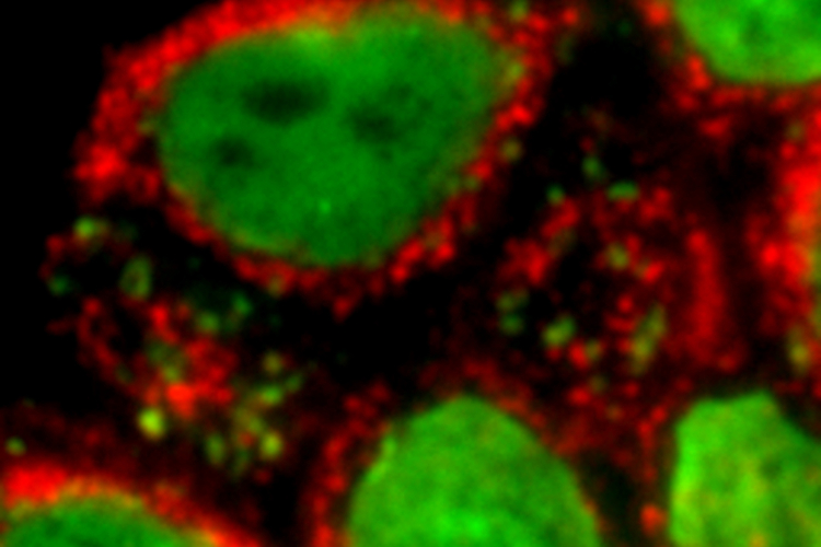 Autoimmunerkrankungen bei Muskelschwund