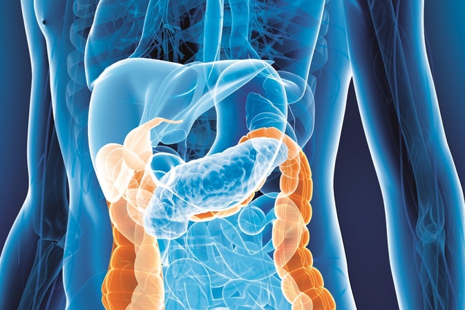 Darmkrebsmonat März: Forschung hilft