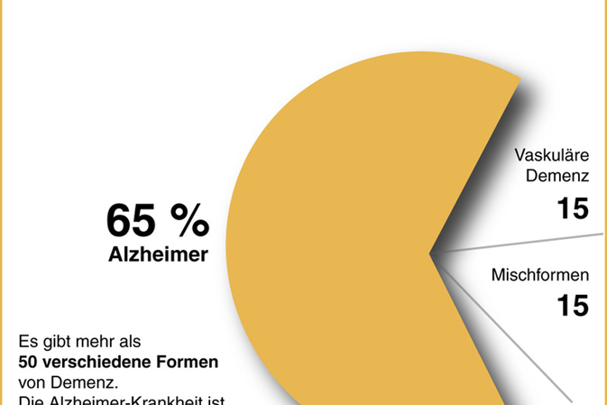 Die vielen Gesichter von Alzheimer