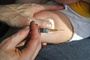 Schutz vor schweren RSV-Infektionen: Stiko empfiehlt Impfung von Neugeborenen