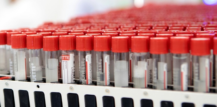 Diagnostik: Neue Methode testet Patientenproben gleichzeitig auf hunderte Viren