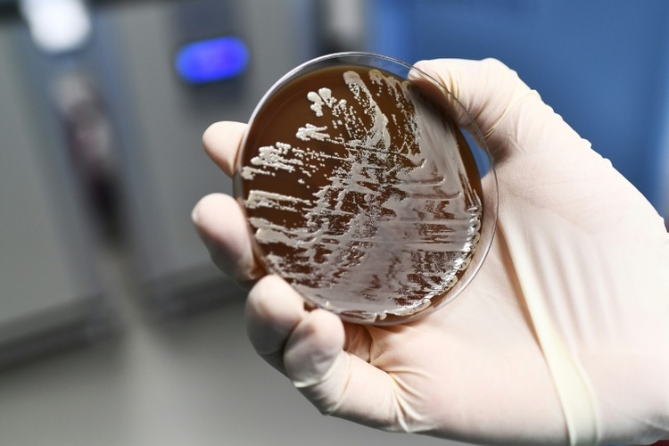 RKI: 9600 Menschen durch antibiotikaresistente Erreger gestorben