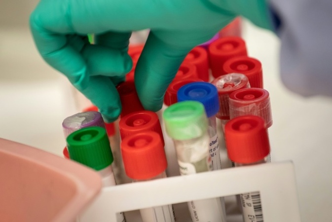WHO hebt höchste Alarmstufe für Infektionskrankheit Mpox auf