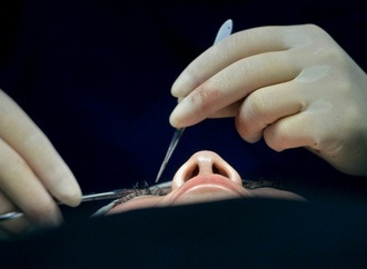 Boom von Abnehmspritzen verändert Schönheitschirurgie: Mehr Straffungseingriffe