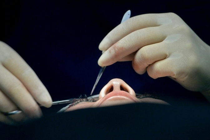 Boom von Abnehmspritzen verändert Schönheitschirurgie: Mehr Straffungseingriffe