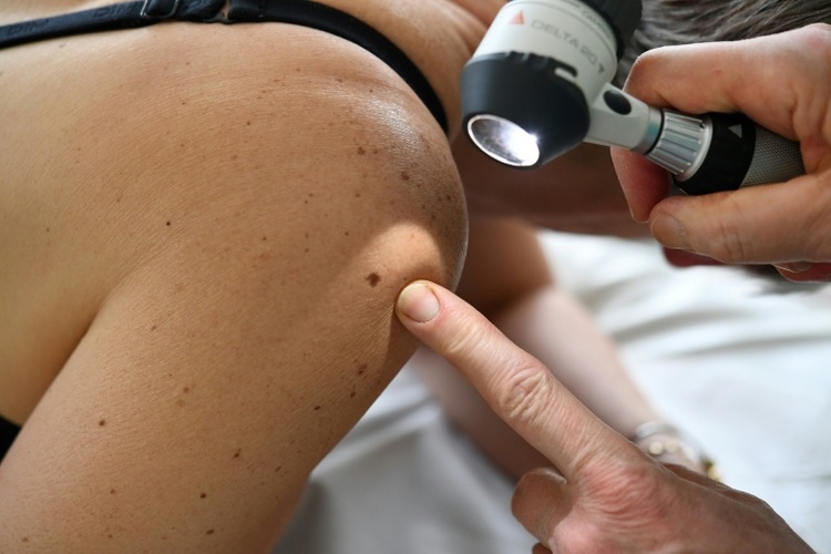 RKI: Etwa 517.800 Menschen erhielten 2023 Krebsdiagnose - Sterblichkeit rückläufig