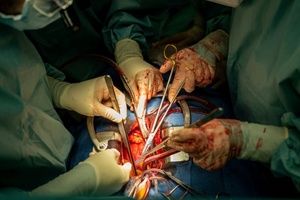 Zahl der Organspenden auf höchsten Stand seit über zehn Jahren