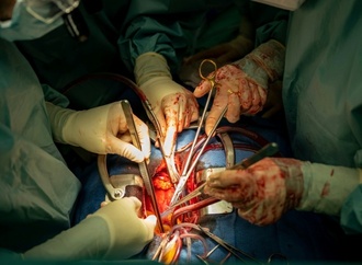 Zahl der Organspenden auf höchsten Stand seit über zehn Jahren