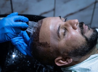 Zahl der Schönheits-OPs bei Männern fast verdoppelt