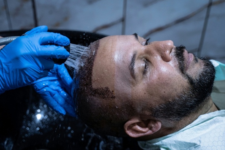 Zahl der Schönheits-OPs bei Männern fast verdoppelt