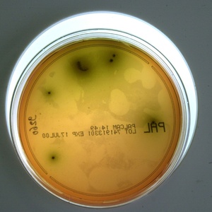 Rückruf von Lebensmitteln: Listerien sind häufigste Ursache