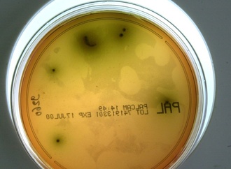 Rückruf von Lebensmitteln: Listerien sind häufigste Ursache