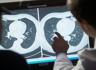 Studie: Individuelle Alterung hat Einfluss auf Krebsrisiko