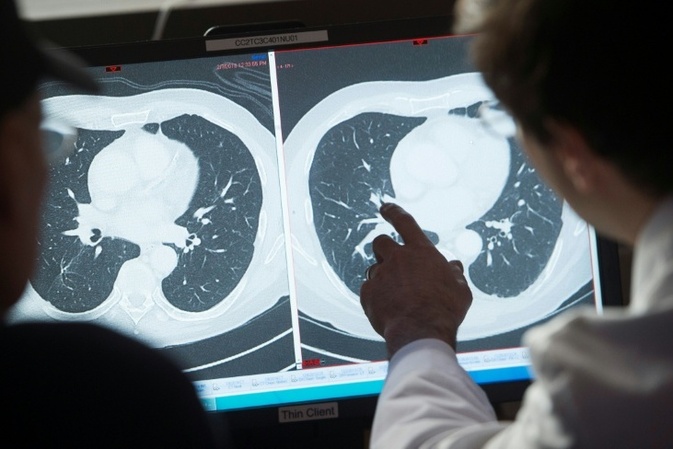 Studie: Individuelle Alterung hat Einfluss auf Krebsrisiko