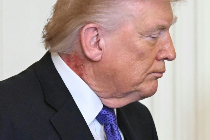 Trump: Gesundheitscheck ist ''perfekt'' verlaufen