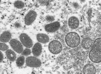 Mpox-Viren im Gepäck: Ermittlungsverfahren gegen zwei Virologen von US-Institut