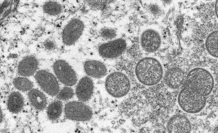 Mpox-Viren im Gepäck: Ermittlungsverfahren gegen zwei Virologen von US-Institut