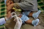UNO warnt vor neuen Epidemien durch mangelnde Impfung bei Kindern