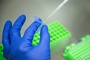 Genschere Crispr: Erste reguläre Behandlung von Patient in Deutschland