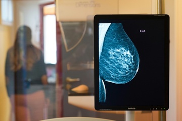 Mammografie: Altersgrenze für Brustkrebs-Früherkennung wird herabgesetzt